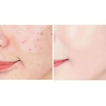 Flaming BB PODKŁAD krem z kolagenem grzybek photoshop  ANGEALA  NATURAL